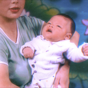 VCD和胎记