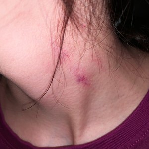 Поцелуи на шее