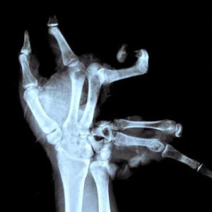 Lobotomy (feat. Xeno!)