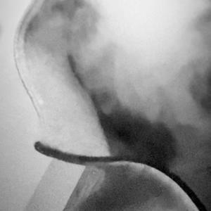 wym (feat. 6klled & kidracks) (Explicit)