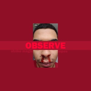 Observe