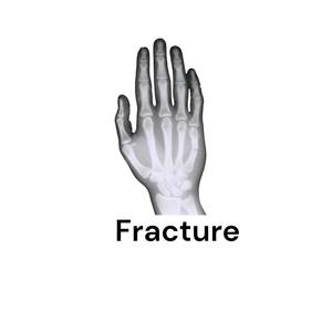 Fracture (Explicit)