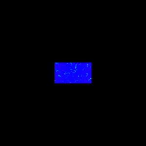 Manifest (Explicit)