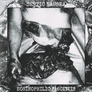 Split W/ Septic Nausea