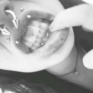 iwannabegone #edgy (Explicit)