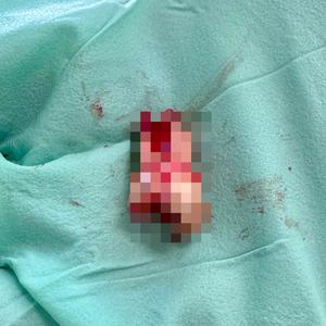 CUT THE ROOT (Explicit)