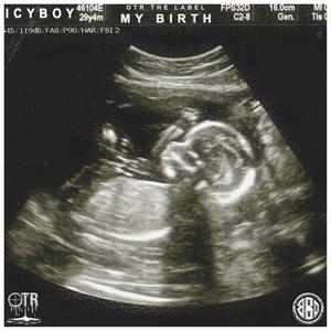 My Birth (Explicit)