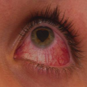NO HEART EYES (Explicit)