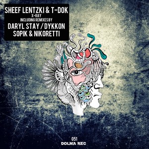 X-Ray (Sopik, Nikoretti Remix)