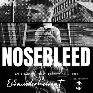 n o s e b l e e d