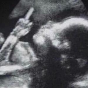 Neonato (Explicit)
