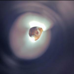 2025113 (Explicit)