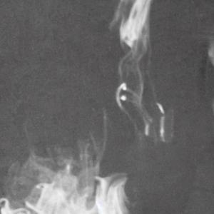 Forget It (Explicit)