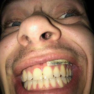 DOMMEDAG (feat. AXEL OLSEN)