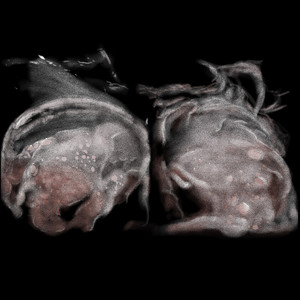 Luminosity (Explicit)