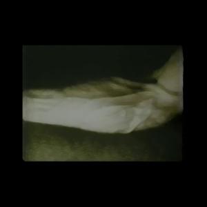 Wolken sind Schimmel (feat. Konrad Dachs) (Explicit)