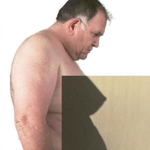 goeo!(square brackets can only be used if you have parentheses in front)[after unbtiteld haha]..