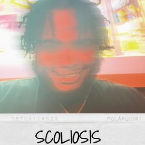 Scoliosis (Explicit)