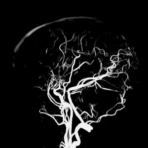 Further attempts at solace interrupted (feat. Alex Murphy & Mike Massaro)