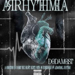 Arrhythmia