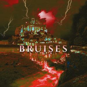 Bruises (Explicit)