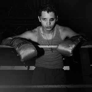 Síndrome del Niño de Oro