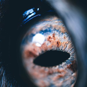 Eye