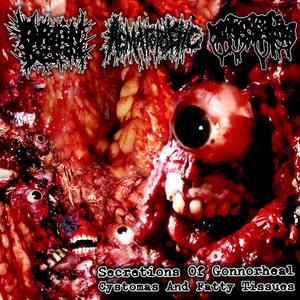 Blood Fountain (Explicit)