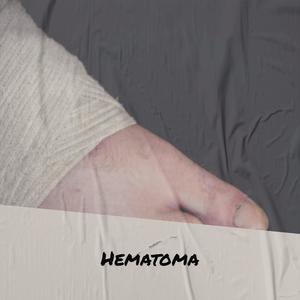 Hematoma