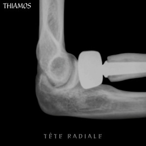 Tête Radiale (Explicit)