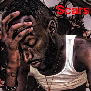 Scars