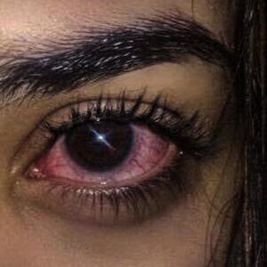 ZAPAL **** (Explicit)