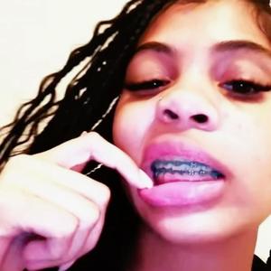 Braceface (feat. Tyhollow) (Explicit)