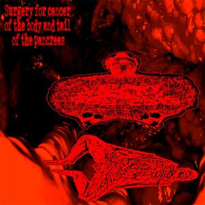 Untitled Improvisation No. IV