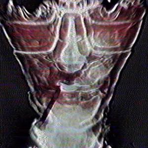 Face of Emotions, Fatal Explosions