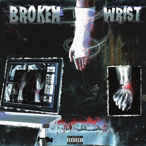 Broken Wrist (Explicit)