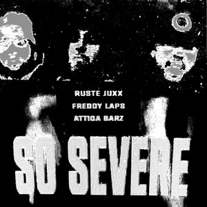So Severe (Explicit)