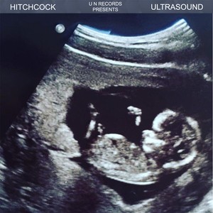 Ultrasound