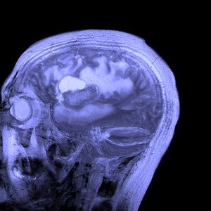 Moctezuma (Explicit)