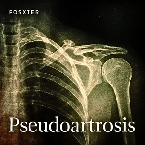 Pseudoartrosis