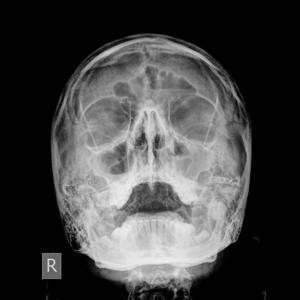 no mask (feat. 5tarr Double) (Explicit)