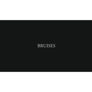 Bruises