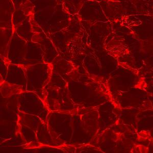 LOSTWORLD (Explicit)