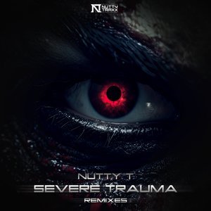 Severe Trauma (The Fallen Remix)