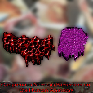 Gangrenous Necrosis Bacterium on the Human Anatomy (Explicit)