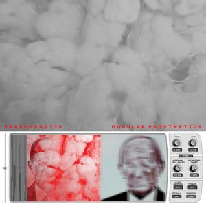 Modular Prosthetics 5