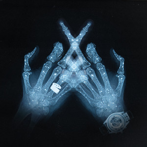 X-RAY (Explicit)