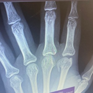 R.I.P (feat. ELcasper & KELLZETERNAL) (Explicit)