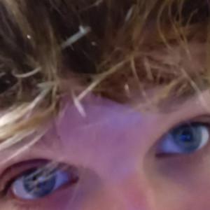 Squiiliam Syndrome (Explicit)