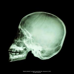 BRAIN DAMAGE (feat. Holyrayne)